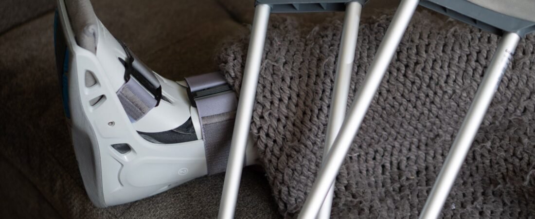Broken Ankle Recovery Time: What To Really Expect