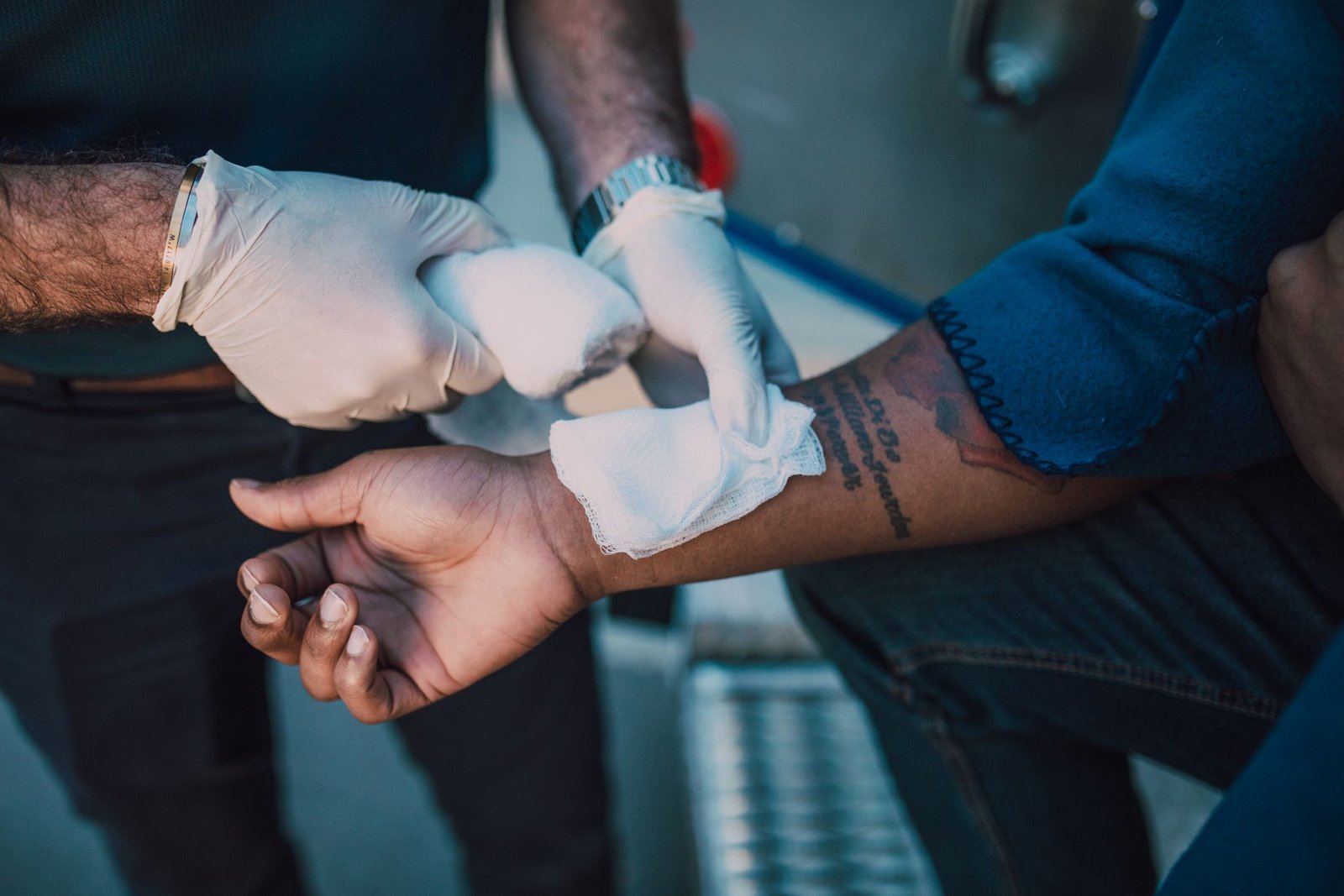 Elbow Dislocation: What Happens And Recovery Time