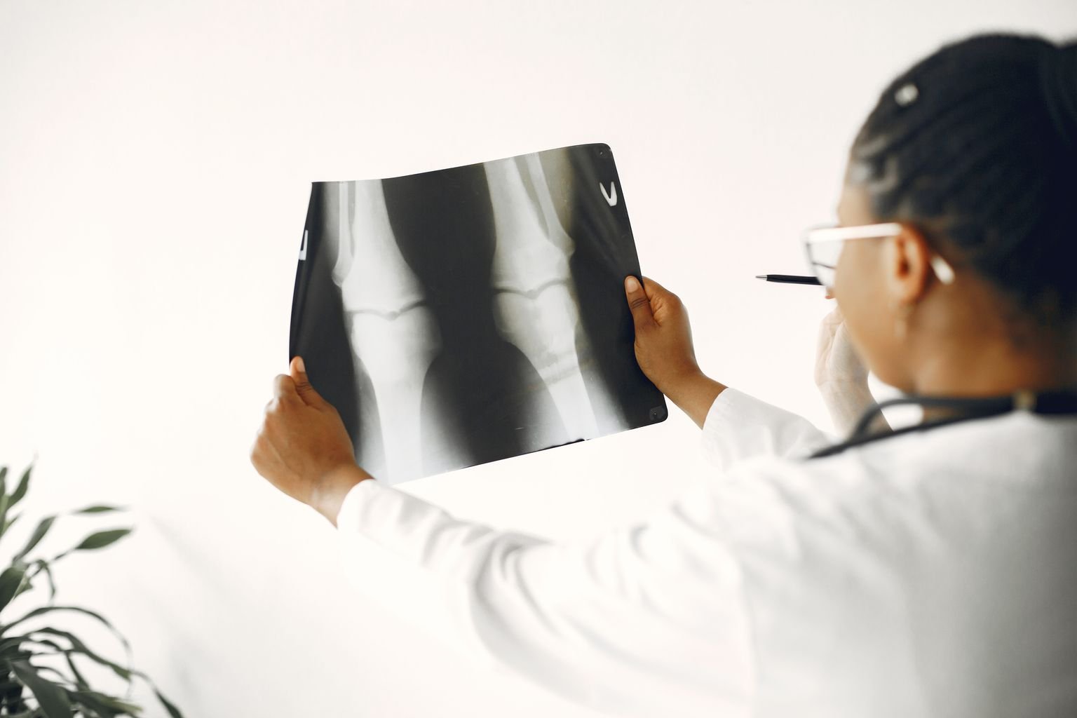 Doctor reviewing a knee x-ray as part of a medial knee pain diagnosis