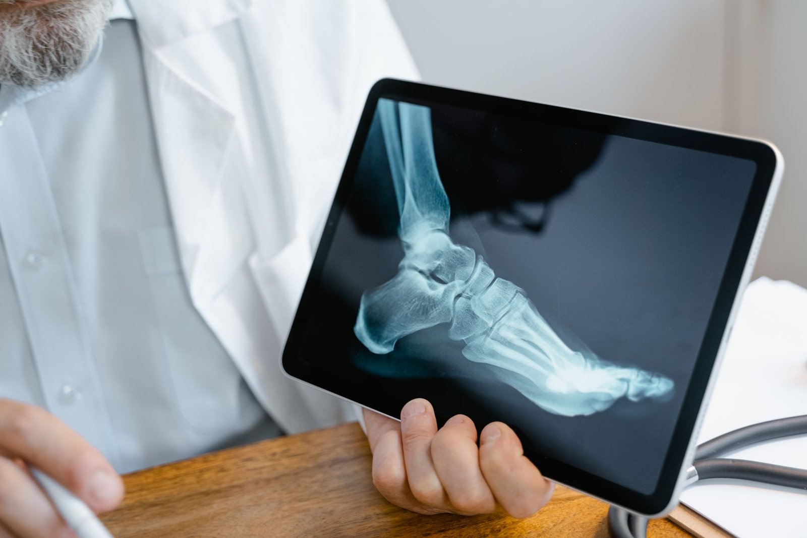 Medial Ankle Sprain: A Complete Guide