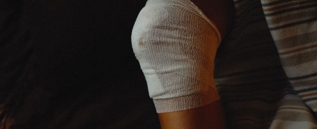 MCL Tear Treatment: What Actually Works
