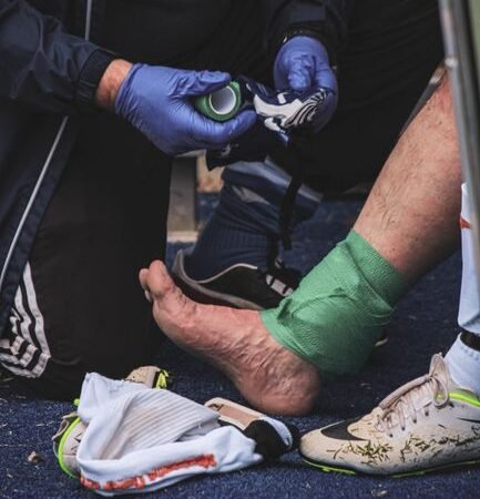 High Ankle Sprain Pictures: What It Actually Looks Like