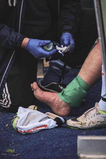High Ankle Sprain Pictures: What It Actually Looks Like