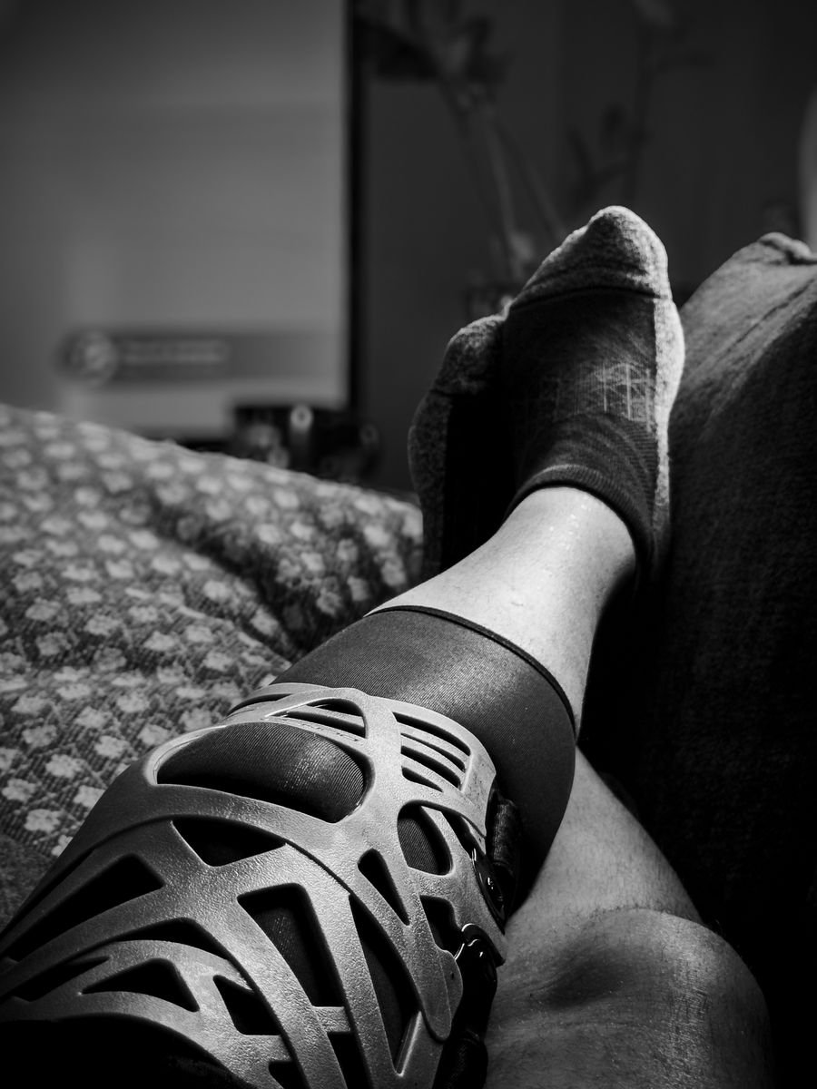 Swelling After Knee Replacement: Explained Simply