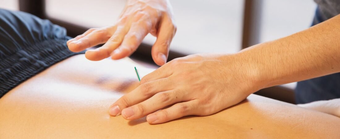 Does Acupuncture Work For Sports Injuries? Here’s What The Evidence Says