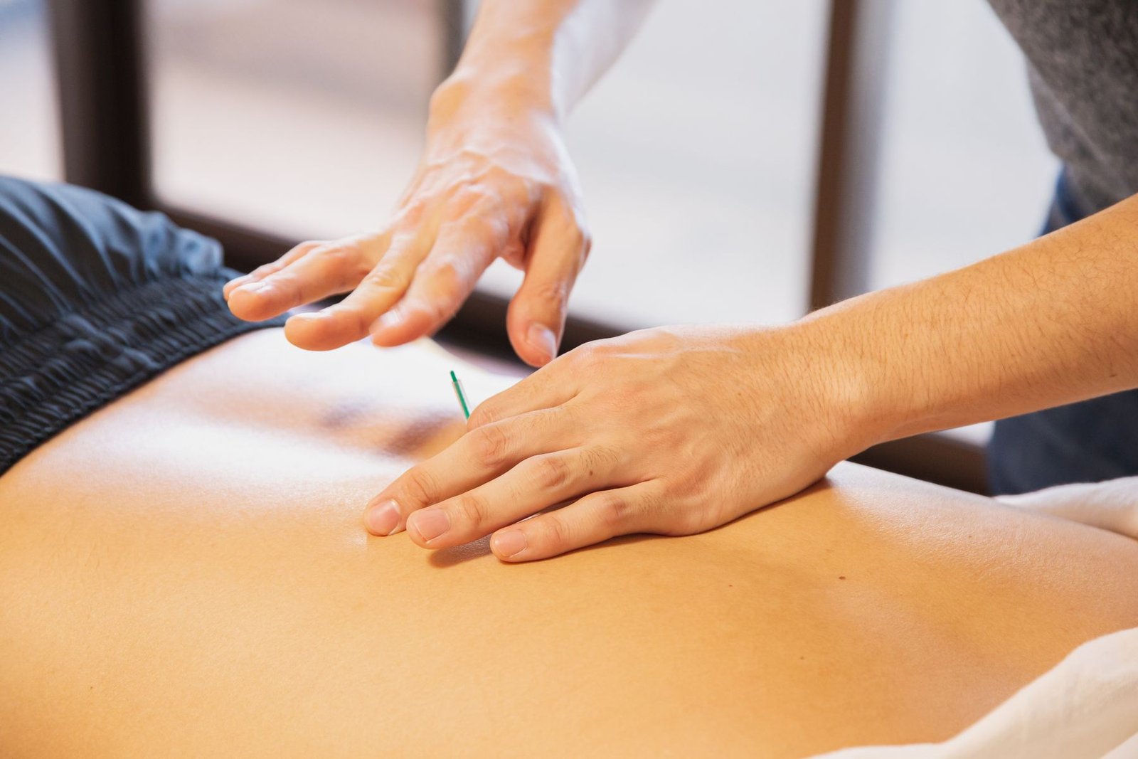 Practitioner performing acupuncture on a client's back, illustrating whether acupuncture works for sports injuries