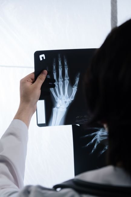Doctor reviewing an X-ray to check for a fracture after a FOOSH injury