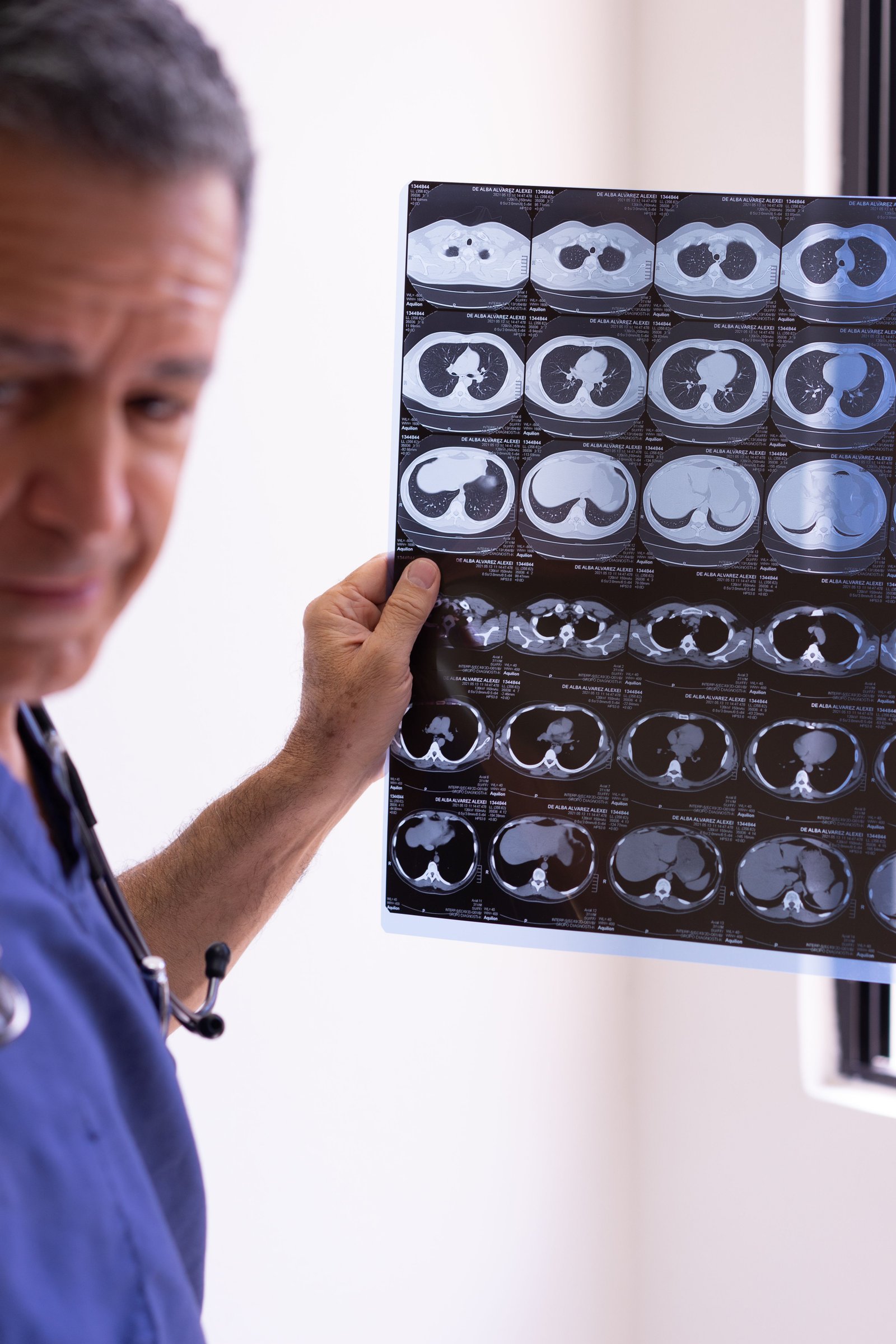 Doctor reviewing imaging to confirm a suspected stress fracture ankle